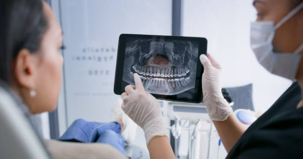 Licensed Tooth Extraction service in Gainesville, GA - Smile Center Dentistry